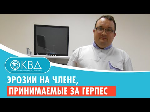 😟 Эрозии на члене, принимаемые за герпес. Клинический случай №728