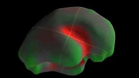 Fetal MRI Showcase