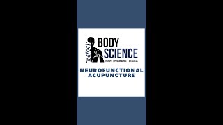 Neurofunctional Acupuncture