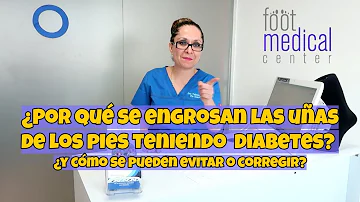 ¿Por qué los diabéticos no pueden cortarse las uñas?