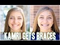 Kamri Gets Braces! | Behind the Braids Ep.4