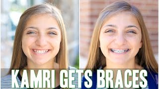 Kamri Gets Braces! | Behind The Braids Ep.4 Kamri Gets Braces! | Behind The Braids Ep.4