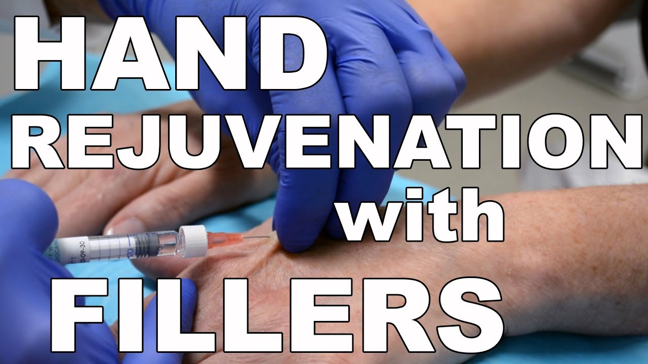 youtube-video-thumbnail