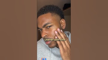 How to solve UNEVEN skin tone #skincare #skintones #serum #clearskin #treatment