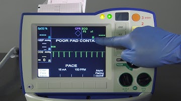 R Series Support Functions - v14