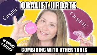 ORALIFT UPDATE W BEFORE & AFTERS - COMBINING WITH OTHER TOOLS