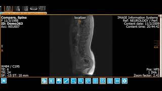 iQ-4VIEW: Parking a Study screenshot 5