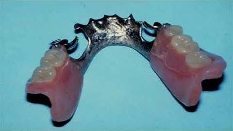 Prosthodontic, Introduction and classification