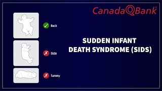 Sudden Infant Death Syndrome (SIDS): Causes, Risk Factors & Prevention | Pediatrics Review screenshot 5