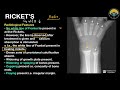 UG Lecture 4 (Part 2) : Bones - Metabolic