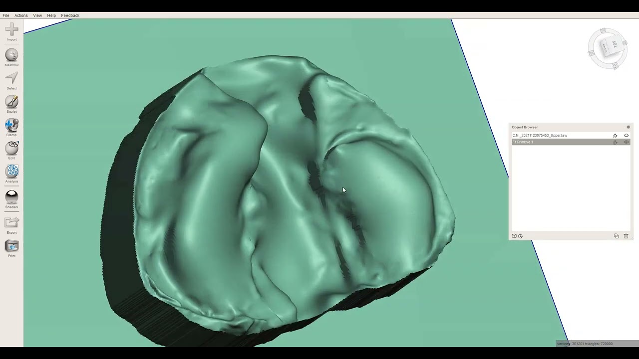 meshmixer Professional Block Out undercuts for dental models