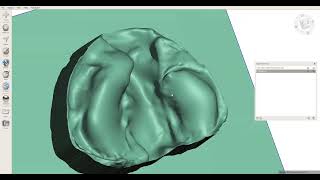meshmixer Professional Block Out undercuts for dental models