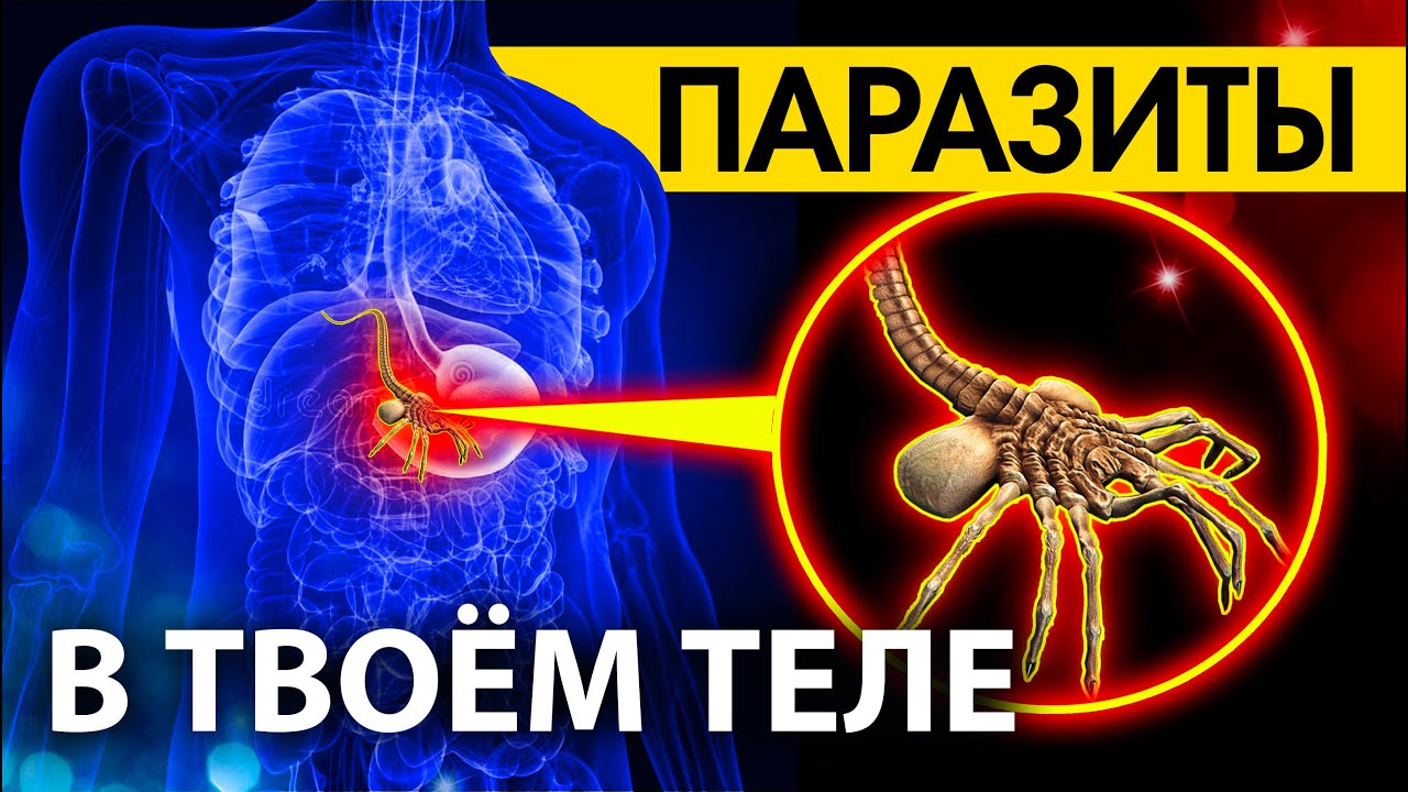 ПАРАЗИТЫ В ТВОЕМ ТЕЛЕ / Симптомы, средства и профилактика - YouTube