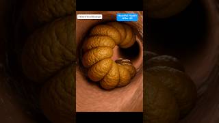 Hyper-Realistic Medical Animation Of Severe Constipation From Dehydration