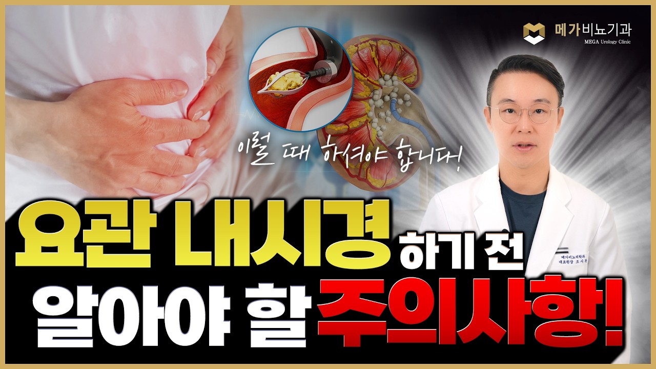 요로결석치료, 내시경 수술 꼭 해야 하는 경우는 따로 있다? 요관 내시경 수술 전 알고 있어야 할 주의사항! [메가비뇨의학과 ...