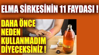 Elma Sirkesinin 11 Faydası Daha Önce Neden Kullanmadım Diyeceksiniz 