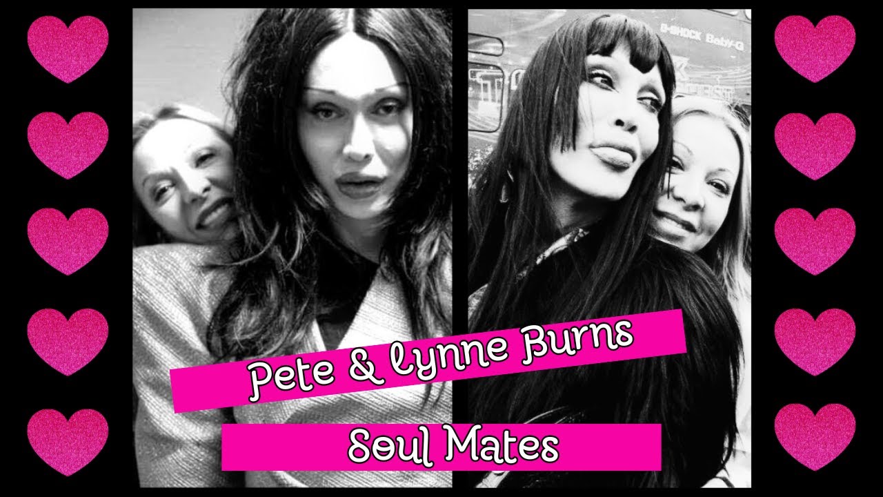Dead Or Alive | Pete Burns: Pete & Lynne Soulmates