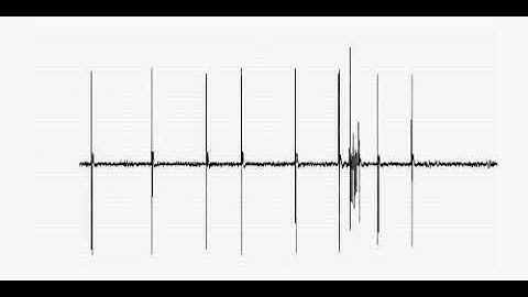 Single unit recording of the simple spike and complex spike activity of a Purkinje cell.