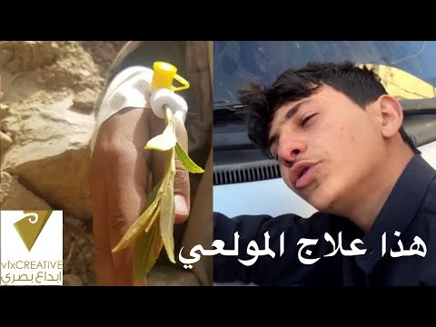 صدموه اسعفوه والا مشهد تمثيلي مضحك