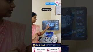 Pregnancy ఎందుకు రాలేదు? #chevelle #sangareddy #vikarabad #shankarpally #pregnancy #doctor #baby