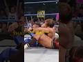Matt Hardy Has Broken His Nose 7 Times!
