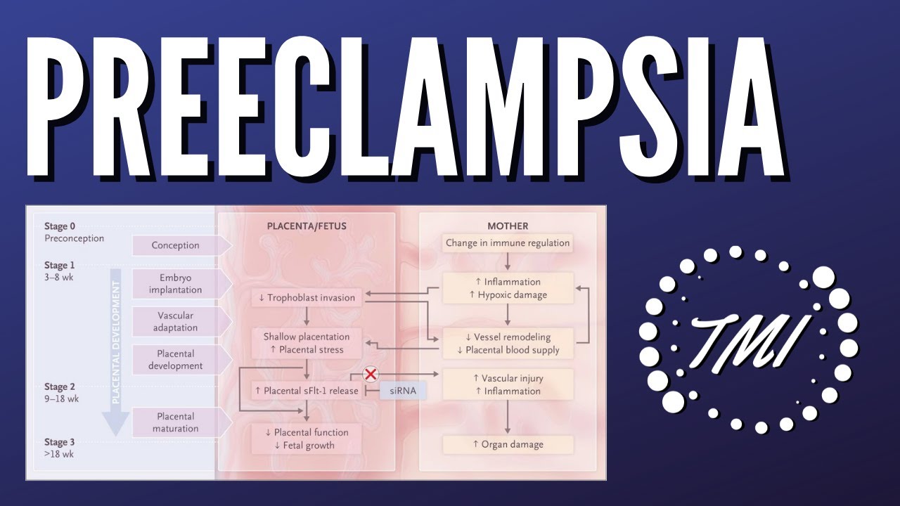 preeclampsia-explicada-claramente-youtube