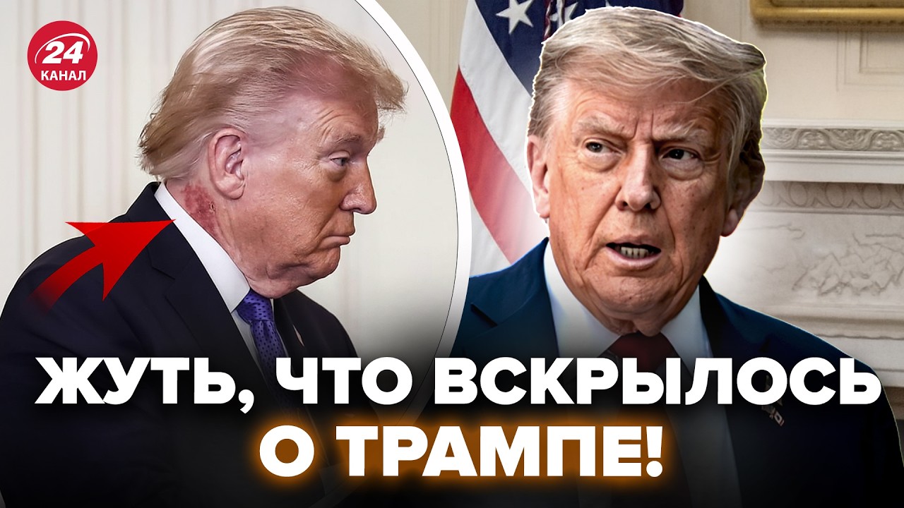 😮ЧТО С ТРАМПОМ? Журналисты РАСКОПАЛИ ТАКОЕ, что гудит весь мир. ЭТО не удалось СКРЫТЬ