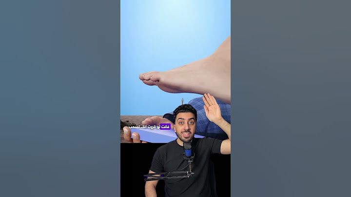 لو مسمار دخل في رجلك
