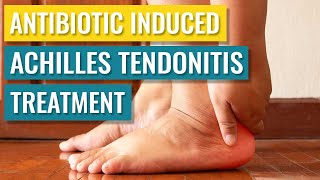 Antibiotic (Cipro) Induced Achilles Tendonitis Treatment by Treat My Achilles 5,099 views 1 year ago 12 minutes, 38 seconds