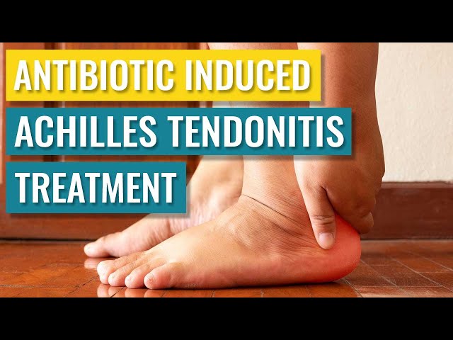 Achilles Tendonitis, Symptoms and Treatment