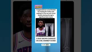 🏀 Playing hurt and still delivering 😤