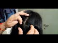 10 minutes soothing scalp checking video to sleep