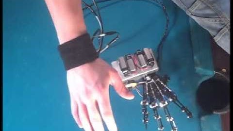 Myoelectric Transradial Prosthesis, Prototype I