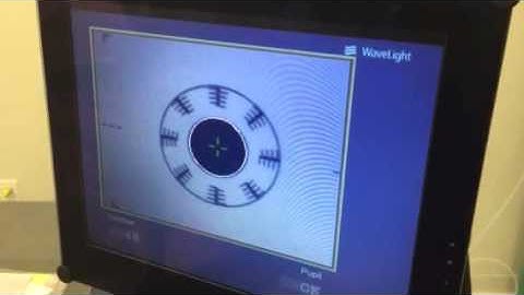 Alcon Allegretto Eye Q 400Hz Excimer Laser System Eye Tracker Test