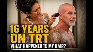 TRT & Hair Loss: What 16 Years Actually Taught Me