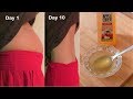 Drink Apple cider Vinegar to lose Belly fat & reduce bloating in 1 week - Weight Loss Drink