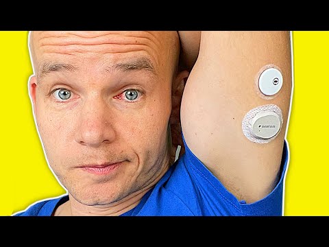 FreeStyle Libre 3 vs Dexcom G7 | Full Test & Review