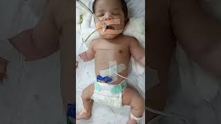 New born baby on ventilator motivation cutebaby mbbs pediatrics trending share nursing