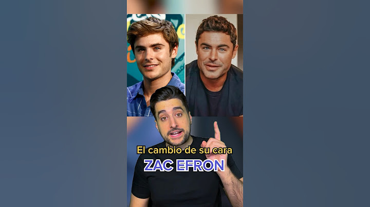 El tremendo motivo de la transformación de la cara de Zac Efron #shorts