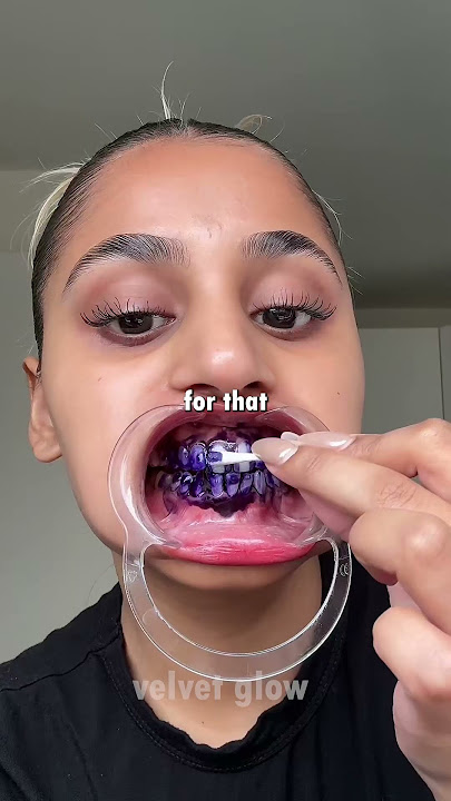 💜 The Truth About Purple Toothpaste HiSmile Review