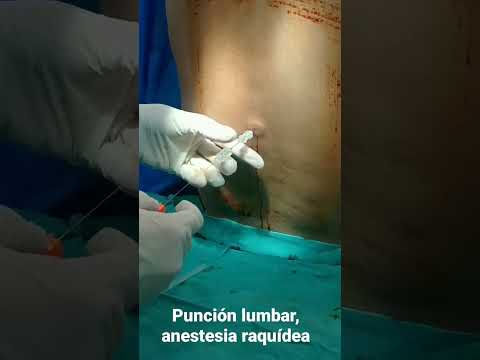 Video: En la punción lumbar se inserta la aguja entre?
