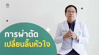 การผ่าตัดเปลี่ยนลิ้นหัวใจ