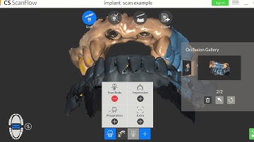 how to scan multiple implants sites using one scan body