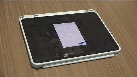 AI being used to diagnose dementia