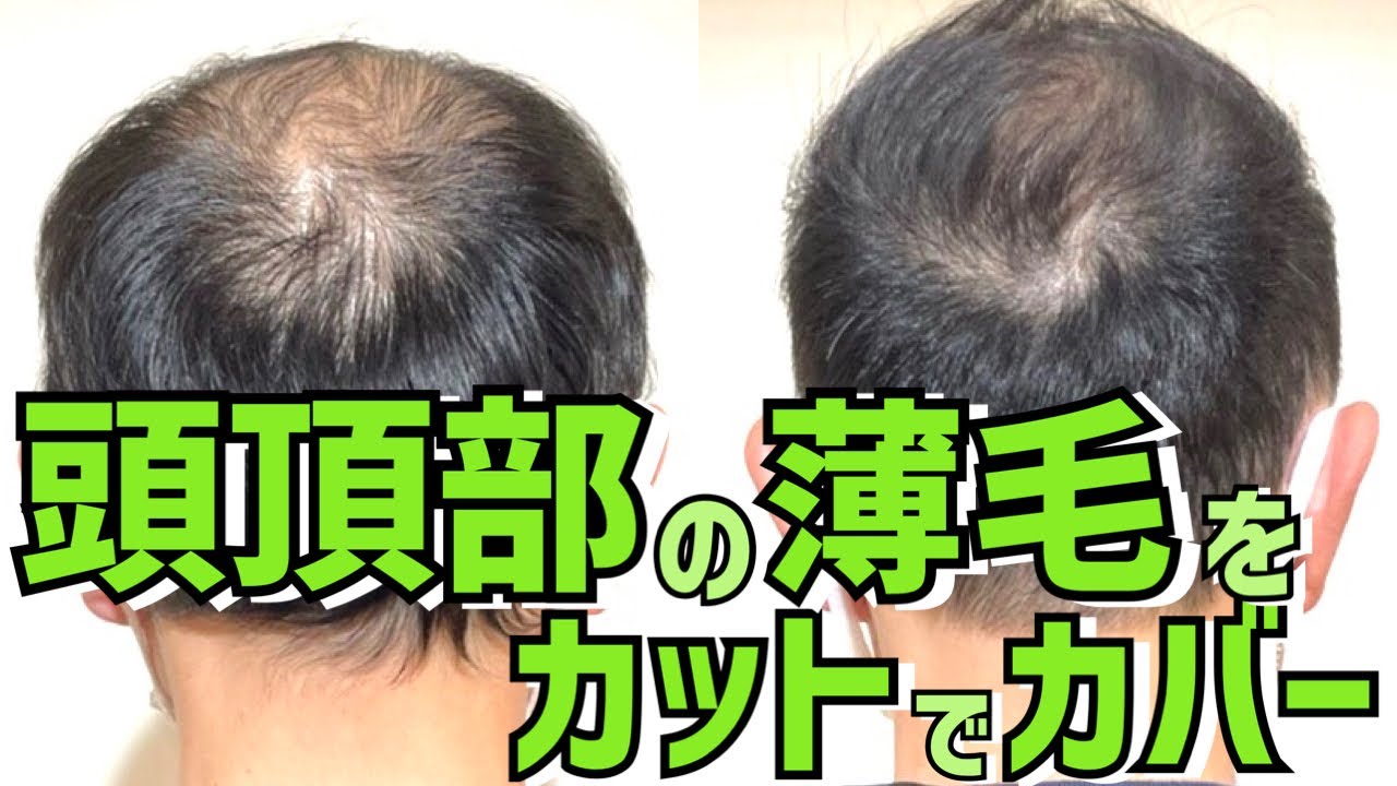 頭頂部薄毛 美容師が教えるハゲをカバーするヘアスタイル Youtube