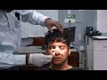 Removing a Nasal Splint on the 7th Day After Rhinoplasty