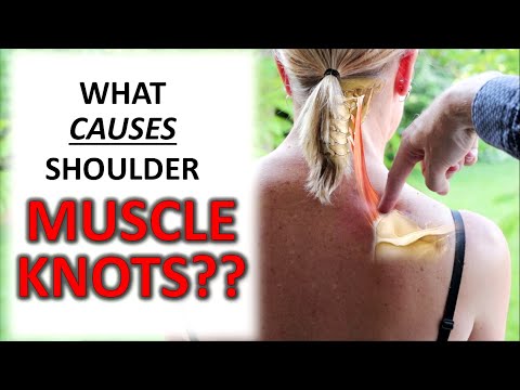 Video: Hva er en knute i skulderen din laget av?