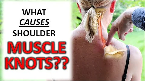 What CAUSES Muscle Knots In Your Shoulders, Traps & Upper Back?