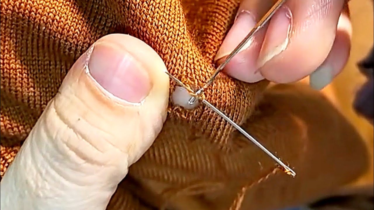 How to Invisibly Repair a Hole in a Knit Sweater at Home - YouTube