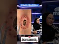 #asmr Remove Maggot & Worm Infected Belly #animation #beauty #animation